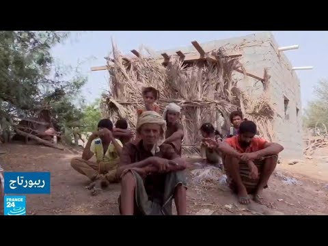 معاناة قرية المكفوفين اليمنية وسبب انتشار العمى فيها