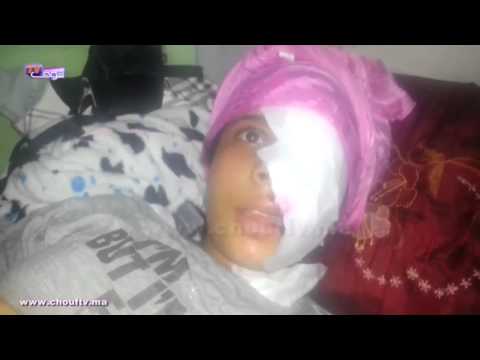 شاهد فتاة تتعرض لاعتداء وتشويه لوجهها