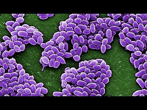 شاهد اكتشاف حالات لشحنات من الجمرة الخبيثة