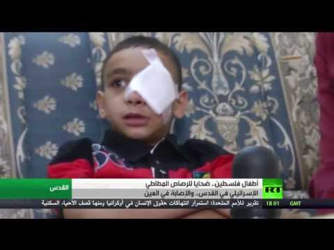 شاهد أطفال فلسطين ضحايا الرصاص المطاطي الإسرائيلي