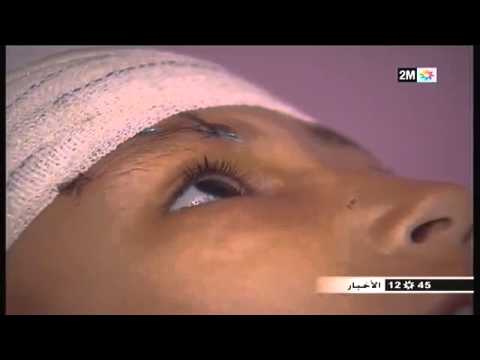 اختطاف وتعذيب طفل في الدار البيضاء