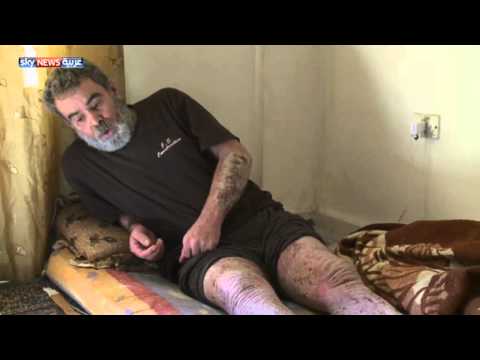 أوضاع صعبة يعانيها لاجئو سوريا بالأردن