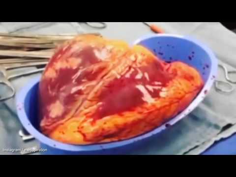 بالفيديو أكتشف ماذا يحدث لقلبك إذا تعاطيت الكوكايين