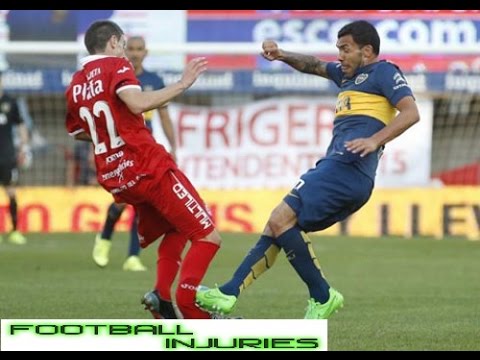 شاهد عمليات كسر الأقدام فى الملاعب