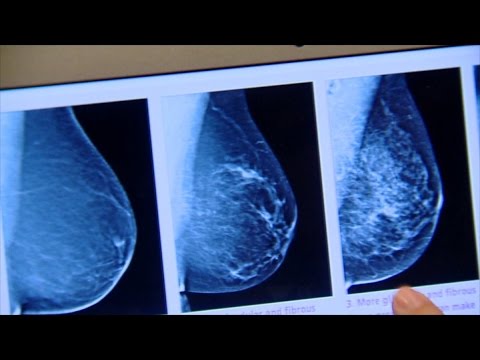 مستشفى يهب الأمل لمرضى سرطان الثدي في الخرطوم