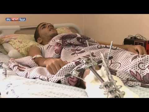 بالفيديو افتقار حاد للأدوية في غزة