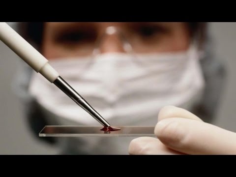 شاهد الأمم المتحدة تحذر من انتشار المرض