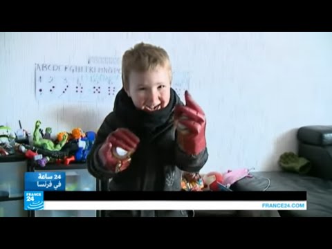 شاهد عملية جراحية هي الأولى من نوعها