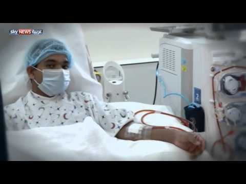 تعرف على فوائد وأضرار غسيل الكلى