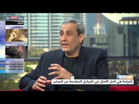 شاهد السمنة ترفع خطر الإصابة بالتهاب المفاصل