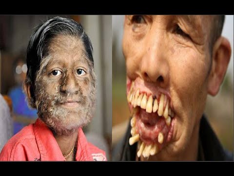 شاهدأغرب 10 أمراض في العالم