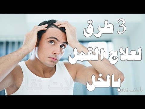 تعرف على 3 طرق للتخلص من القمل نهائيًا