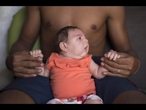 تعرف على أعراض الإصابة بفيروس زيكا وآلية العلاج