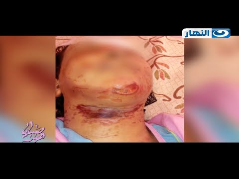 شاهد رجل يعذب طليقته حتي الموت