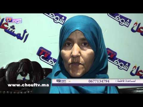 فيديو سيدة مصابة بالتهاب الكبد وتحتاج الدواء