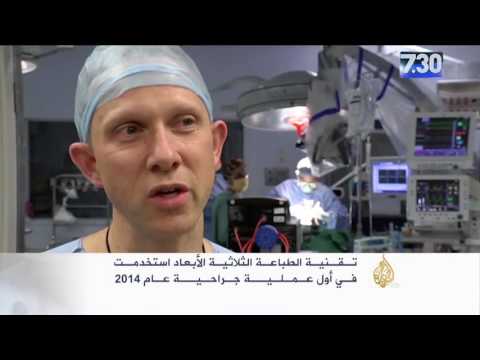 زراعة فقرات صناعية بتقنية الطباعة الثلاثية الأبعاد