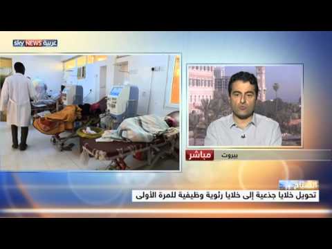 شاهد تحويل خلايا جذعية إلى خلايا رئوية وظيفية