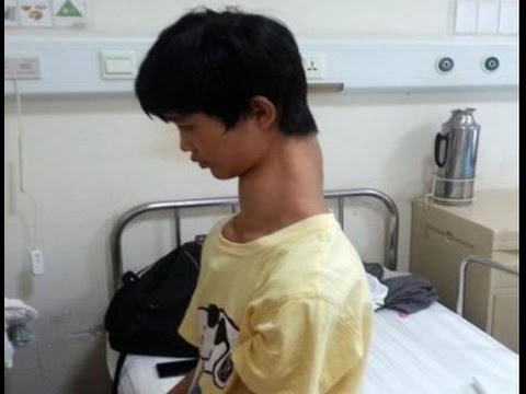 تعرّف على صاحب أطول رقبة في العالم