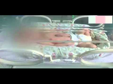بالفيديو ولادة طفل بقلب ينبض خارج جسده