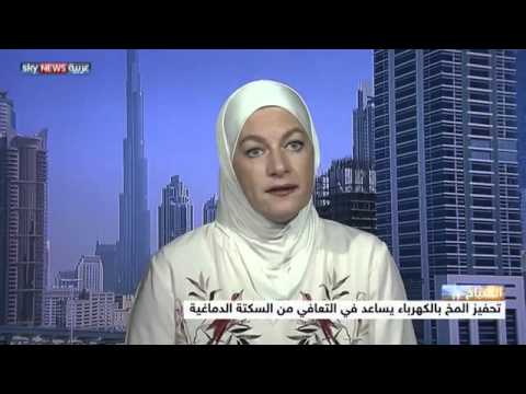 الكهرباء تساعد في التعافي من السكتة الدماغية