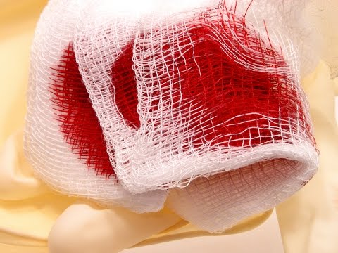 شاهد كيف توقف جميع أنواع النزيف