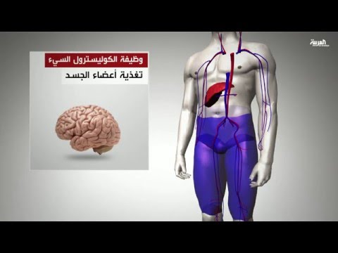 الكوليسترول الجيد لا يقي من النوبات القلبية