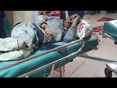 بالفيديو فضيحة بناي ووسادته خشنة في طواريء مستشفى أكادير